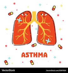 Asthma